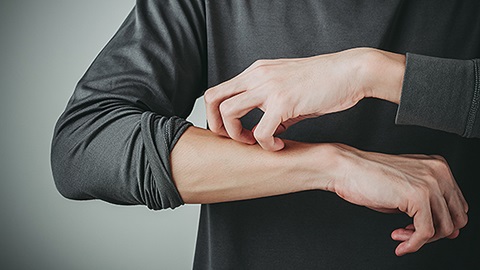 iemand met atopische dermatitis krabt aan zijn arm
